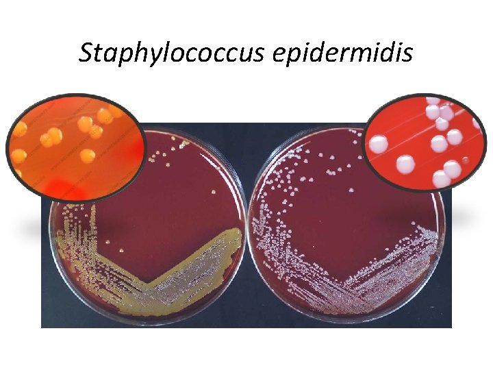 Staphylococcus epidermidis 