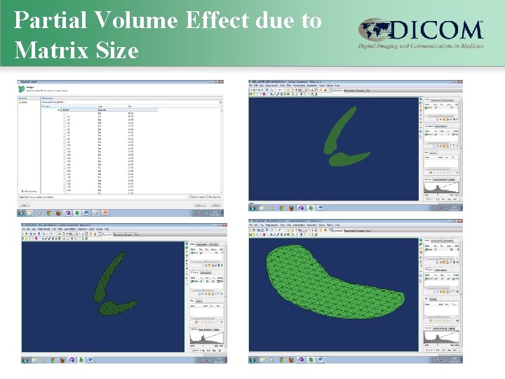 Partial Volume Effect due to Matrix Size 