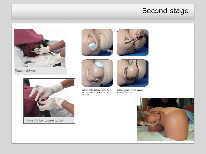 Second stage Second stage