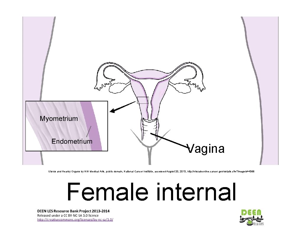 Vagina Uterus and Nearby Organs by NIH Medical Arts, public domain, National Cancer Institute,