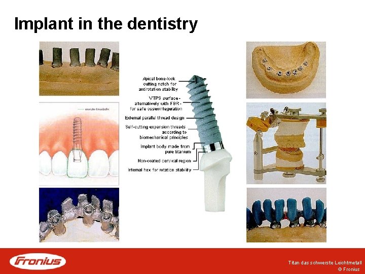Implant in the dentistry Titan das schwerste Leichtmetall © Fronius 