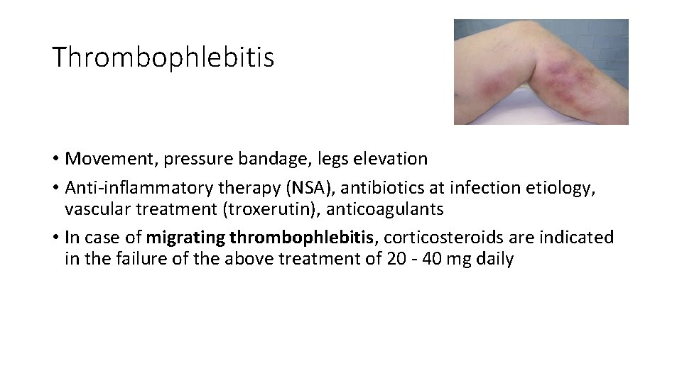 Thrombophlebitis • Movement, pressure bandage, legs elevation • Anti-inflammatory therapy (NSA), antibiotics at infection