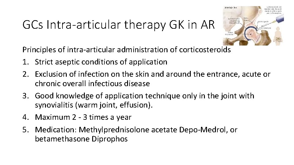 GCs Intra-articular therapy GK in AR Principles of intra-articular administration of corticosteroids 1. Strict