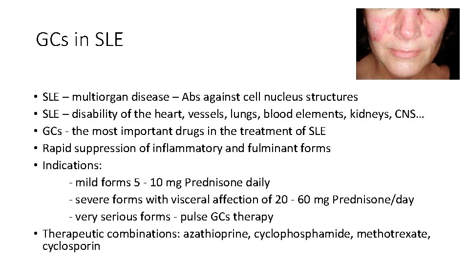 GCs in SLE – multiorgan disease – Abs against cell nucleus structures SLE –