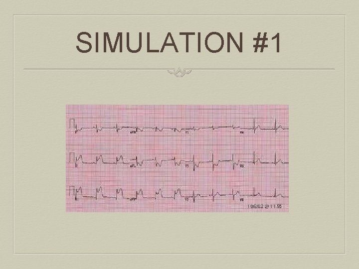 SIMULATION #1 