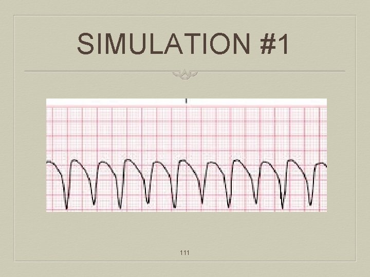 SIMULATION #1 111 