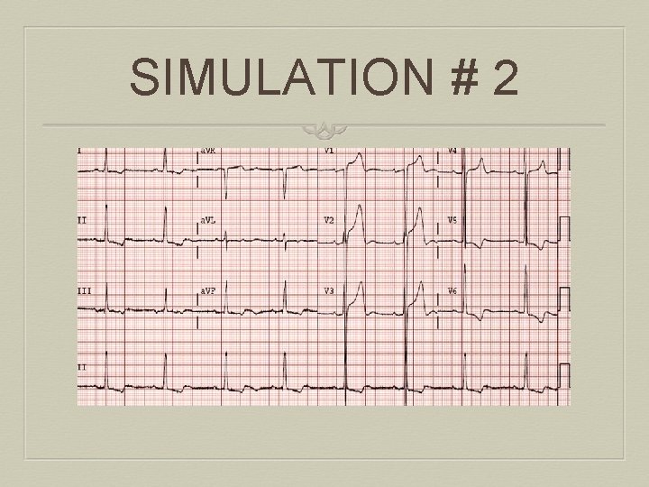 SIMULATION # 2 