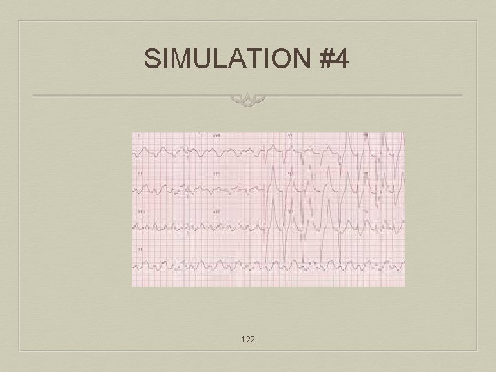 SIMULATION #4 122 
