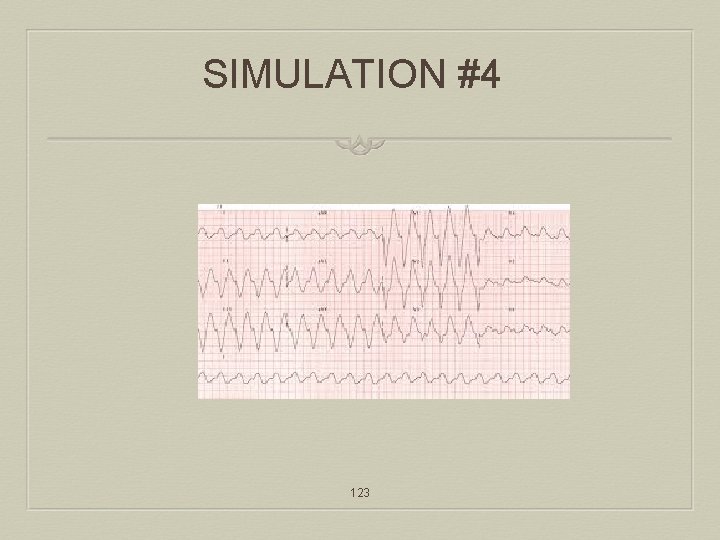 SIMULATION #4 123 