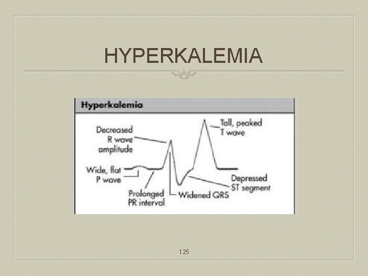 HYPERKALEMIA 125 
