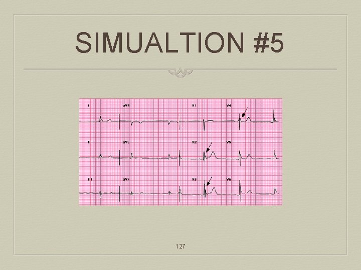 SIMUALTION #5 127 
