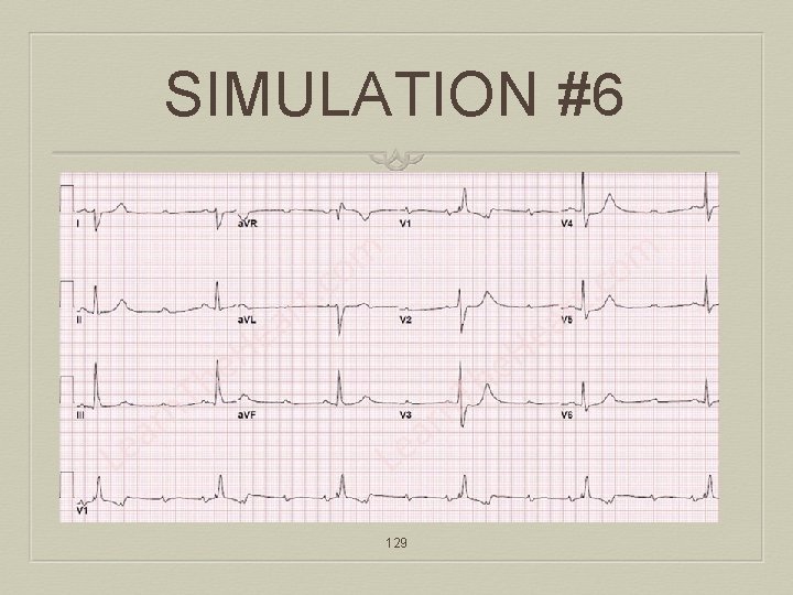 SIMULATION #6 129 