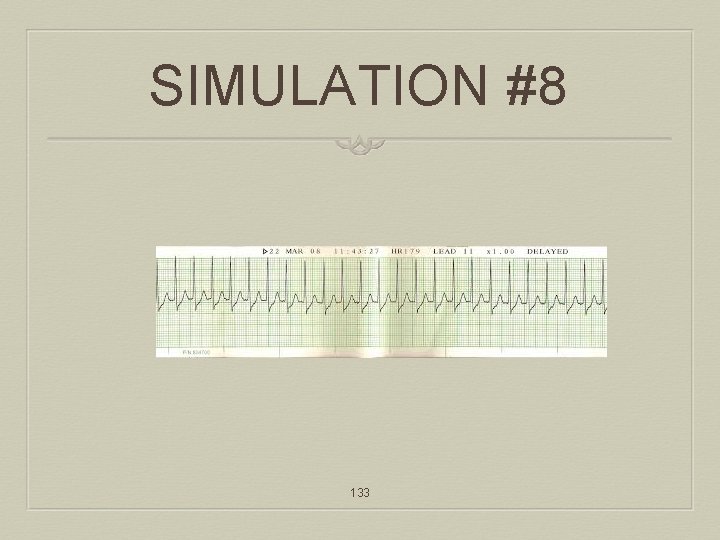 SIMULATION #8 133 