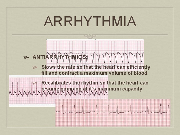 ARRHYTHMIA ANTIARRHYTHMICS: Slows the rate so that the heart can efficiently fill and contract