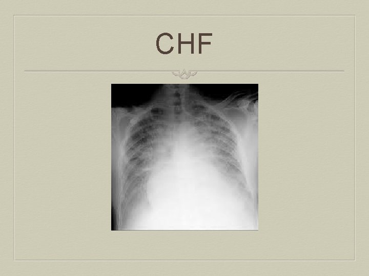 CHF 
