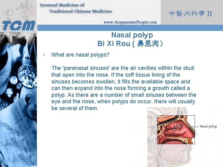 Nasal polyp Bi Xi Rou ( 鼻息肉） • What are nasal polyps? The 'paranasal