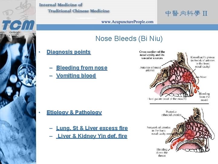 Nose Bleeds (Bi Niu) • Diagnosis points – Bleeding from nose – Vomiting blood