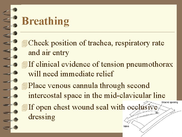 Breathing 4 Check position of trachea, respiratory rate and air entry 4 If clinical