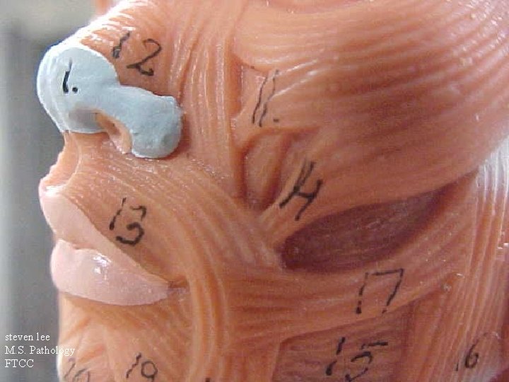steven lee M. S. Pathology FTCC 