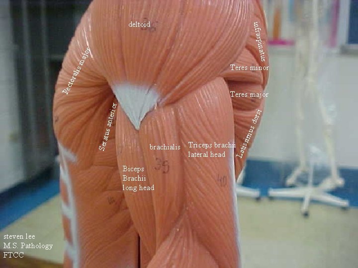 ma jor inatus infrasp deltoid Pec tor alis Teres minor si dor Biceps Brachii