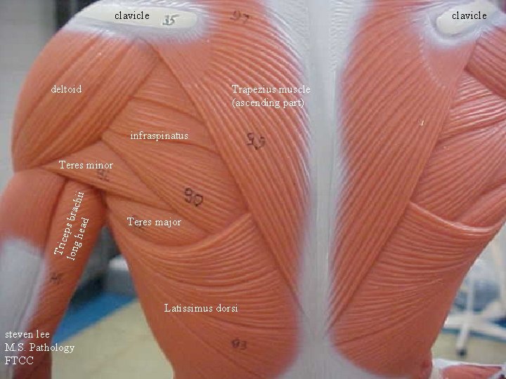 clavicle deltoid Trapezius muscle (ascending part) infraspinatus Tric e long ps brac head hii