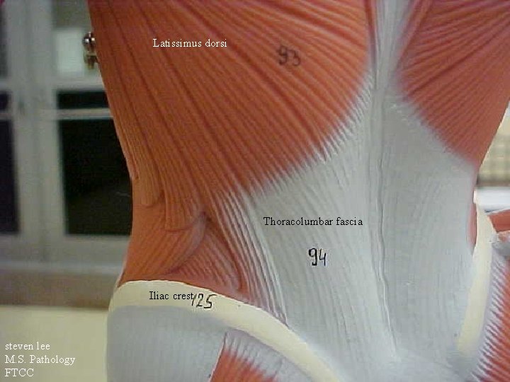 Latissimus dorsi Thoracolumbar fascia Iliac crest steven lee M. S. Pathology FTCC 