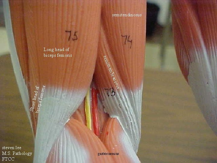 semitendinosus Short h bicep ead of s fem oris s steven lee M. S.