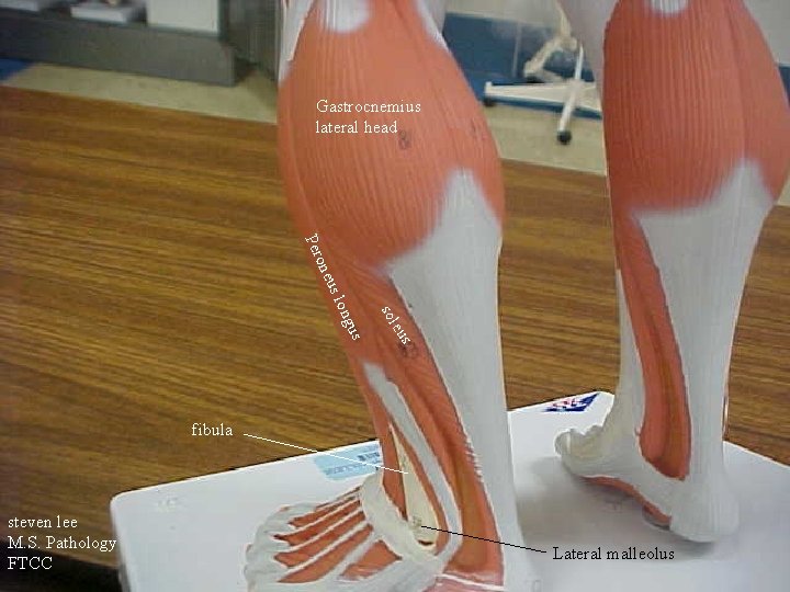 Gastrocnemius lateral head eus sol us ong us l one Per fibula steven lee