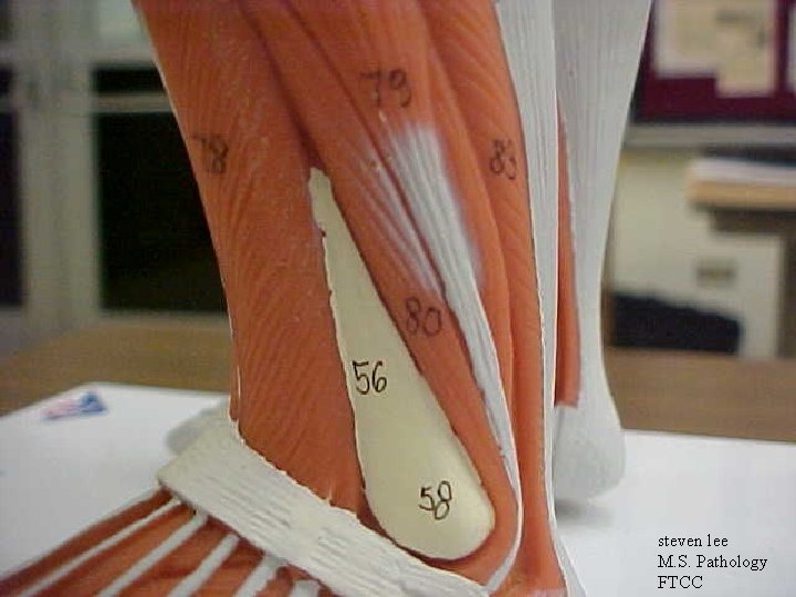 steven lee M. S. Pathology FTCC 