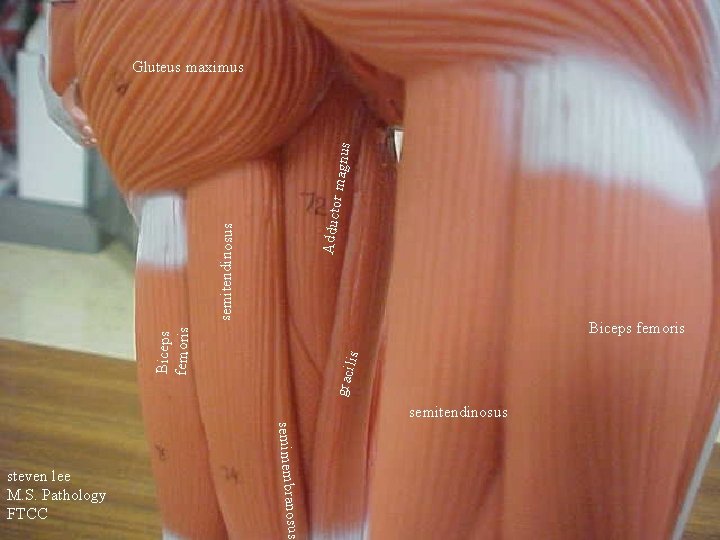 semitendinosus Adducto r magnu s Gluteus maximus graci lis Biceps femoris semitendinosus semimembrano steven