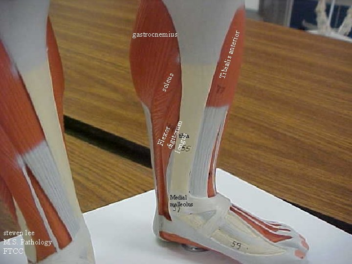 Flex digi or t long orum us sol eus Tibi alis ante rior gastrocnemius