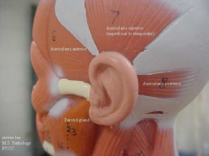 Auricularis superior (superficial to temporalis) Auricularis anterior Auricularis posterior Parotid gland steven lee M.