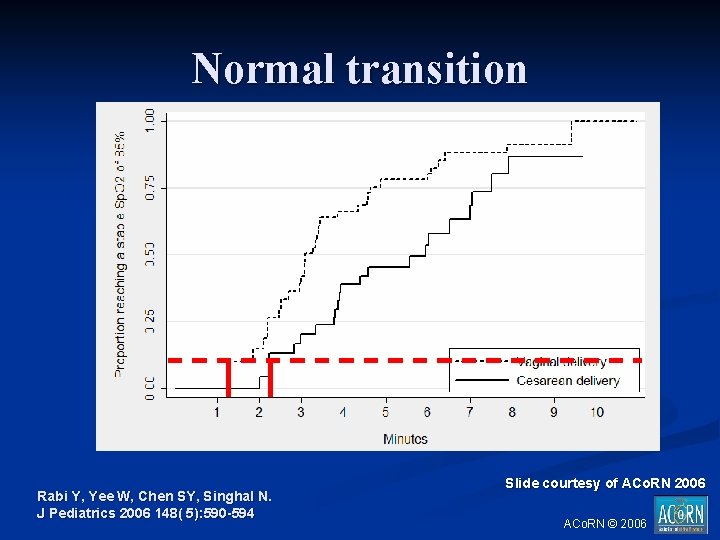 Normal transition Rabi Y, Yee W, Chen SY, Singhal N. J Pediatrics 2006 148(