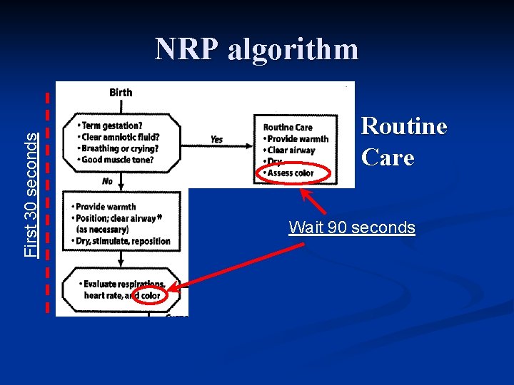 First 30 seconds NRP algorithm Routine Care Wait 90 seconds 