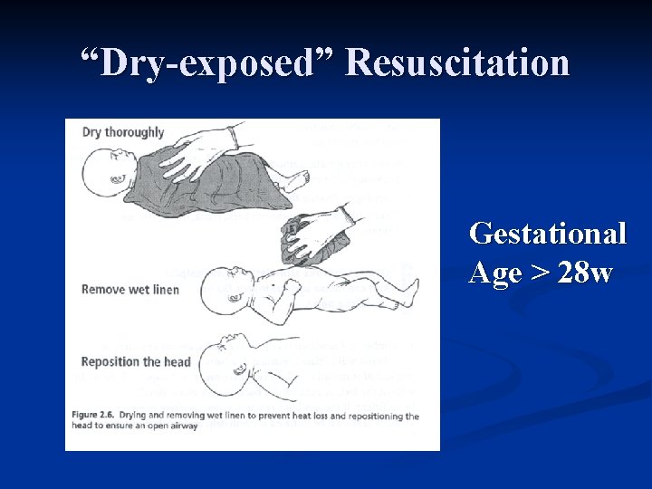“Dry-exposed” Resuscitation Gestational Age > 28 w 