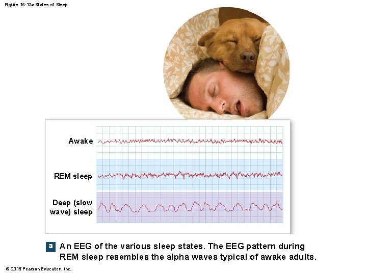 Figure 16 -12 a States of Sleep. Awake REM sleep Deep (slow wave) sleep