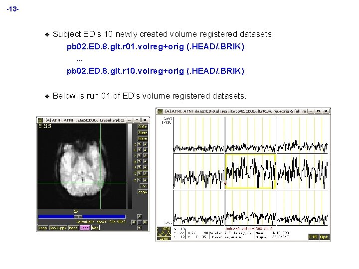 -13 - v Subject ED’s 10 newly created volume registered datasets: pb 02. ED.