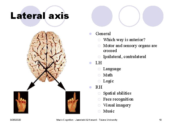 Lateral axis l General ¡ ¡ ¡ l LH ¡ ¡ ¡ l Language Lateral axis l General ¡ ¡ ¡ l LH ¡ ¡ ¡ l Language