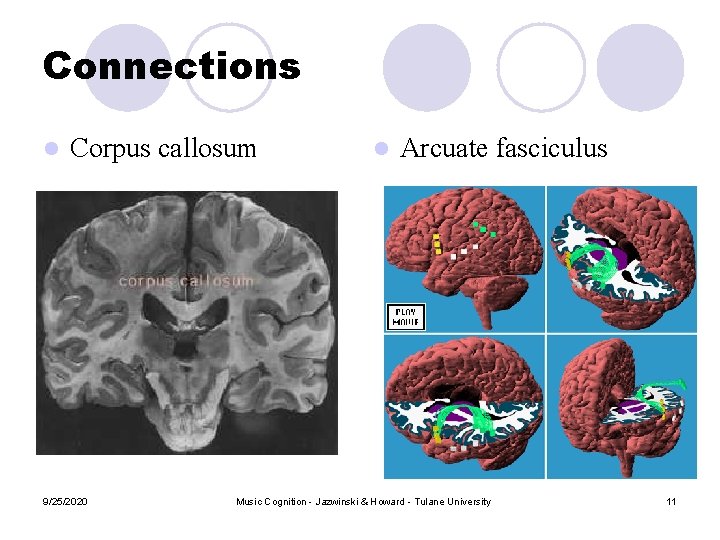 Connections l Corpus callosum 9/25/2020 l Arcuate fasciculus Music Cognition - Jazwinski & Howard Connections l Corpus callosum 9/25/2020 l Arcuate fasciculus Music Cognition - Jazwinski & Howard