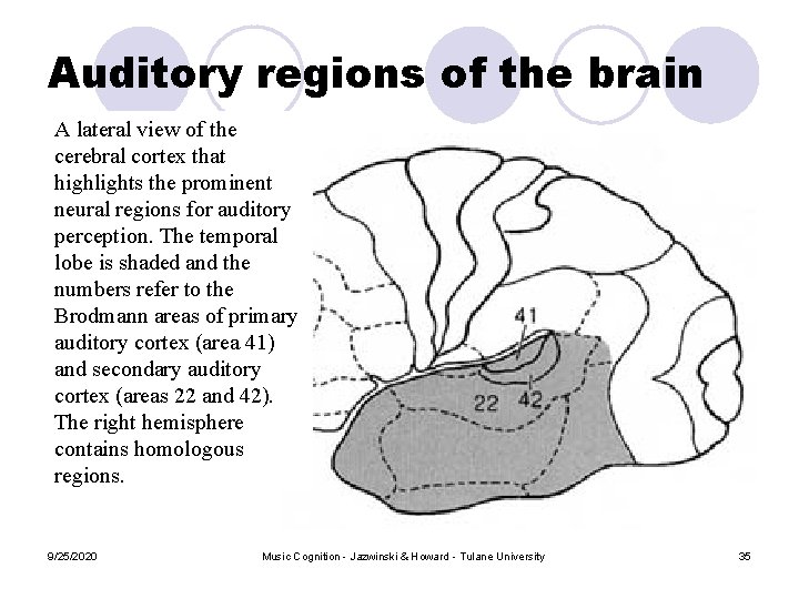 Auditory regions of the brain A lateral view of the cerebral cortex that highlights Auditory regions of the brain A lateral view of the cerebral cortex that highlights