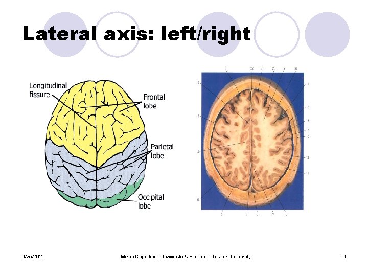 Lateral axis: left/right 9/25/2020 Music Cognition - Jazwinski & Howard - Tulane University 9 Lateral axis: left/right 9/25/2020 Music Cognition - Jazwinski & Howard - Tulane University 9