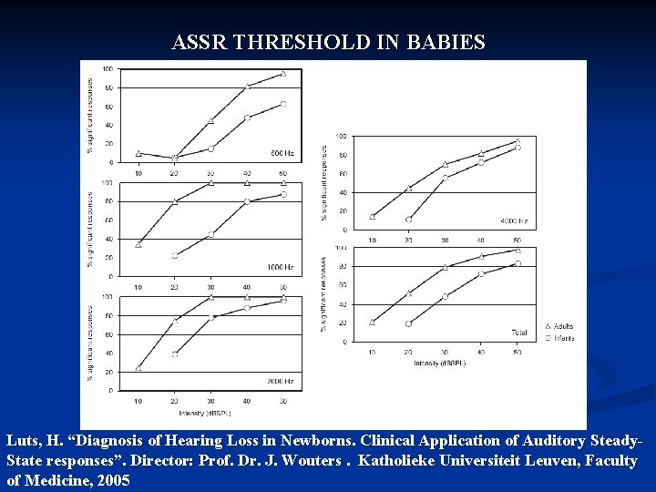 ASSR THRESHOLD IN BABIES Luts, H. “Diagnosis of Hearing Loss in Newborns. Clinical Application