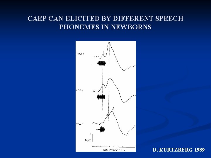 CAEP CAN ELICITED BY DIFFERENT SPEECH PHONEMES IN NEWBORNS D. KURTZBERG 1989 