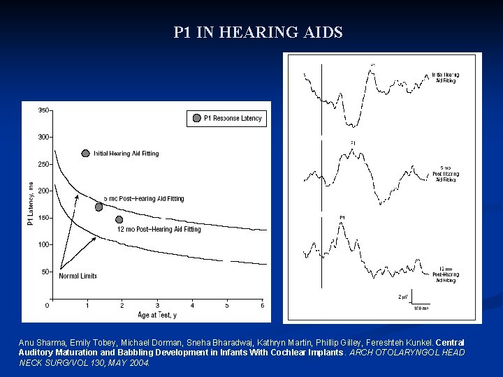 P 1 IN HEARING AIDS Anu Sharma, Emily Tobey, Michael Dorman, Sneha Bharadwaj, Kathryn