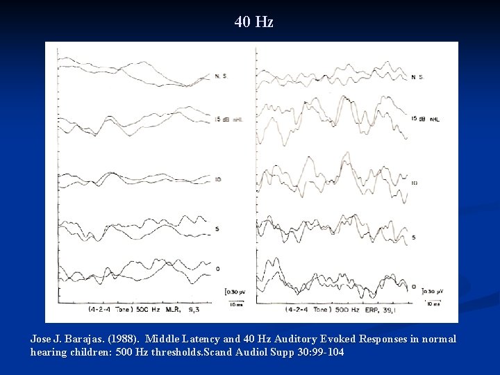 40 Hz Jose J. Barajas. (1988). Middle Latency and 40 Hz Auditory Evoked Responses