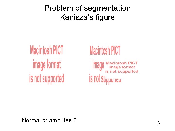 Problem of segmentation Kanisza’s figure Normal or amputee ? 16 