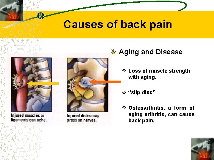 Causes of back pain Aging and Disease v Loss of muscle strength with aging.