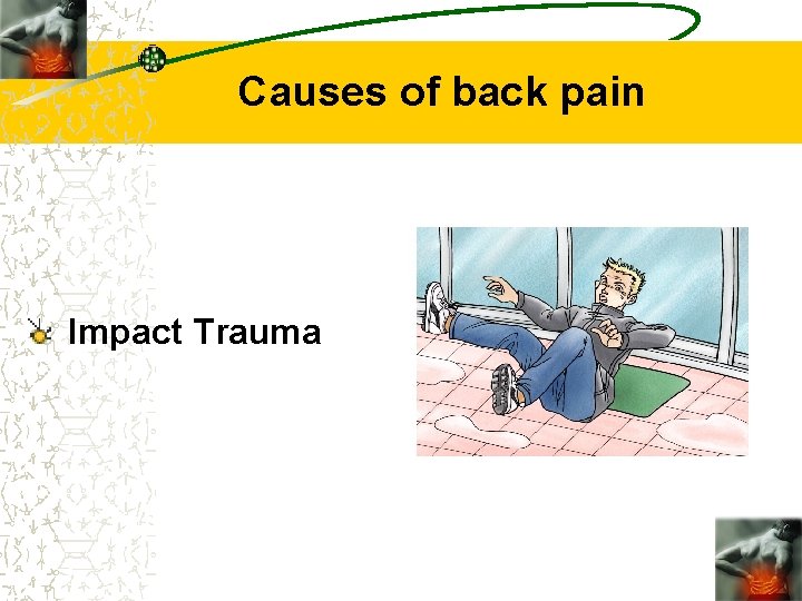 Causes of back pain Impact Trauma 