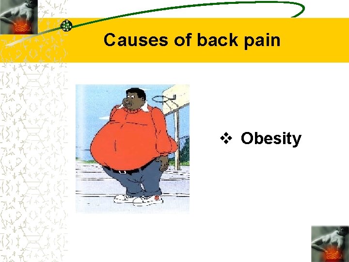 Causes of back pain v Obesity 