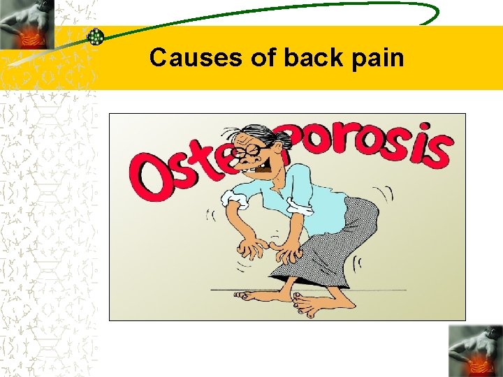 Causes of back pain 